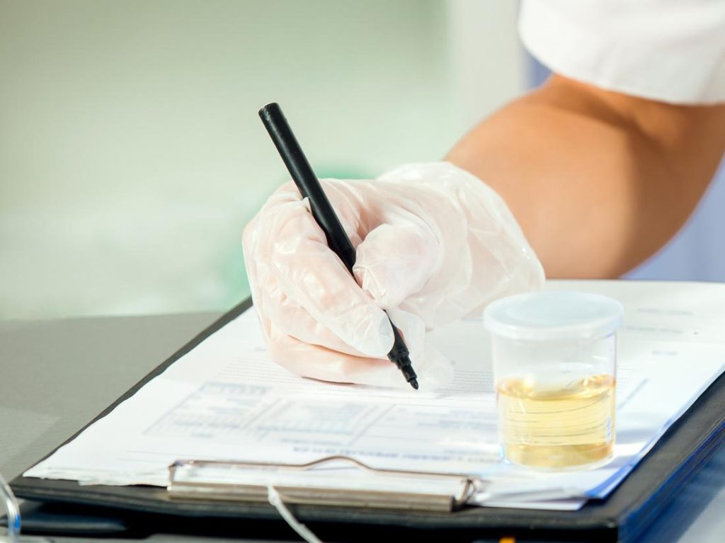 products to use for urine drug testing